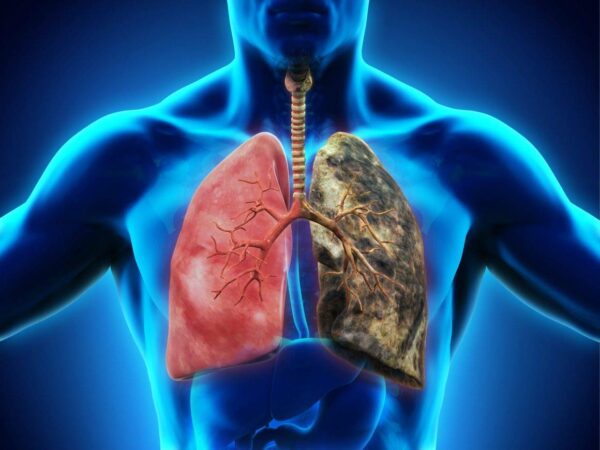 Paquete completo limpieza pulmones y colon con laxante