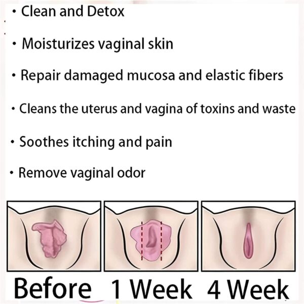 EXGYAN producto Annie Care para frescura y limpieza íntima