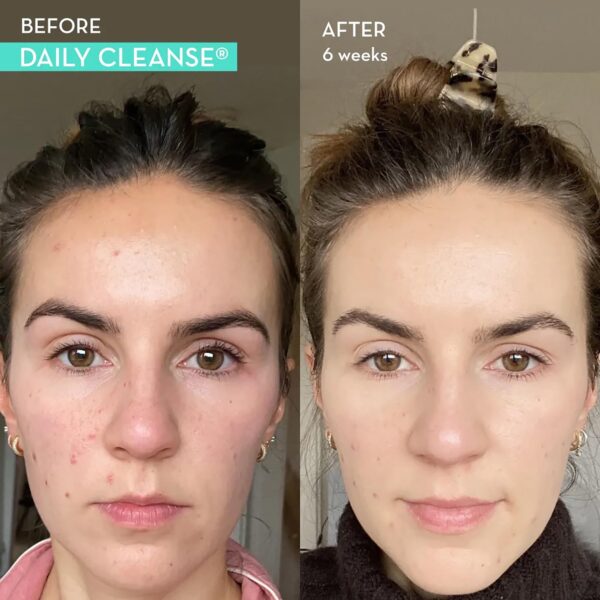 Comprimidos de probióticos vaginales HUM Private Party