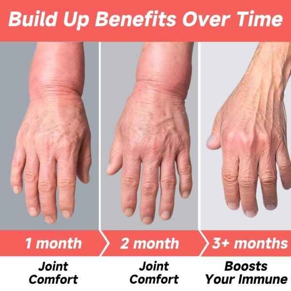 Cápsulas suplemento RindTi para apoyo renal y salud articular