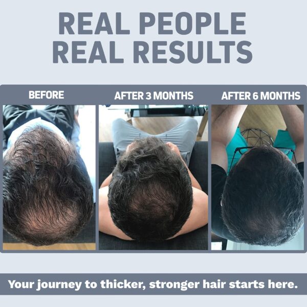 suplemento herbtonics acv keto gomitas apoyo cabello sano