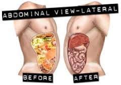 Version 1.0.0 Frasco Miracle Oxy-Colon Cleanse cápsulas vegetarianas limpieza colon