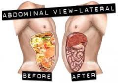 Botellas milagro Limpiador vegano de colon Oxy-Colon